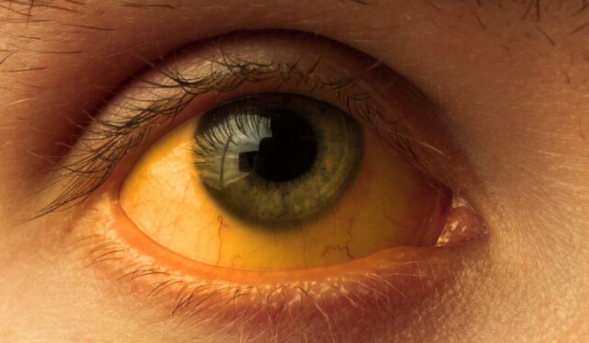 Vyhnite sa cestám do Česka, varuje poľský rezort zahraničia