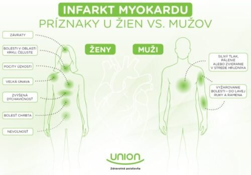 Infarkt u žien sa často prejavuje inak ako u mužov. Netypické príznaky môžu viesť k oneskorenej liečbe
